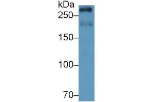 Detection of mTOR in Rat Cerebrum lysate using Monoclonal Antibody to Serine/threonine-protein kinase mTOR (mTOR) (MTOR Antikörper  (AA 2226-2488))