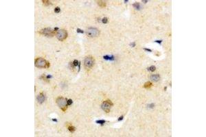 Immunohistochemical analysis of Plasma Kallikrein HC staining in human brain formalin fixed paraffin embedded tissue section. (KLKB1 Antikörper  (Heavy Chain))
