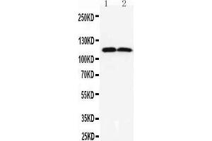 Observed bind size: 114KD (ANO1 Antikörper  (C-Term))