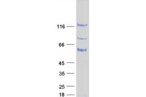 Validation with Western Blot (ARHGAP17 Protein (Transcript Variant 1) (Myc-DYKDDDDK Tag))