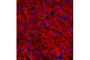 Immunofluorescence (Paraffin-embedded Sections) (IF (p)) image for anti-Myosin Light Chain 6, Alkali, Smooth Muscle and Non Muscle (MYL6) antibody (ABIN7074734)