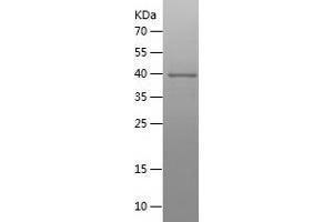 Western Blotting (WB) image for Protein Disulfide Isomerase Family A, Member 3 (PDIA3) (AA 340-505) protein (His-IF2DI Tag) (ABIN7124644) (PDIA3 Protein (AA 340-505) (His-IF2DI Tag))