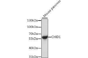 Western blot analysis of extracts of mouse pancreas, using CHID1 antibody (ABIN7266330) at 1:1000 dilution. (CHID1 Antikörper  (AA 1-393))