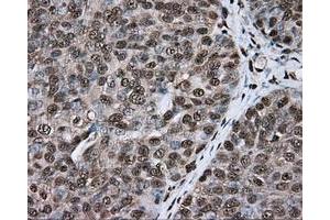 Immunohistochemical staining of paraffin-embedded colon tissue using anti-ERCC1 mouse monoclonal antibody. (ERCC1 Antikörper)