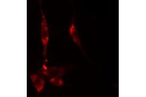 ABIN6274892 staining HeLa cells by IF/ICC. (DDX55 Antikörper  (Internal Region))