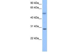 WB Suggested Anti-C17orf81 Antibody Titration: 0. (Retinoic Acid Induced 12 (RAI12) (C-Term) Antikörper)