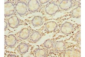 Immunohistochemistry of paraffin-embedded human colon tissue using ABIN7160482 at dilution of 1:100 (MYADM Antikörper  (AA 1-40))