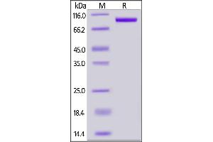 Mouse PSMA, His Tag on  under reducing (R) condition.