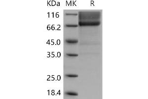 Biglycan Protein (BGN) (Fc Tag)