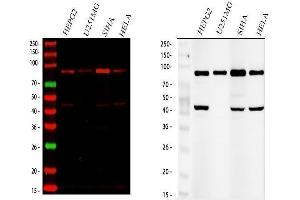 Western blot analysis of SOX6 using anti-SOX6 antibody (ABIN7603012).