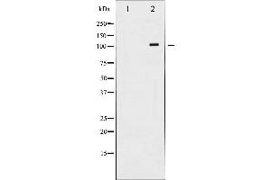 Western blot analysis of PDGFR beta expression in H2O2 treated LOVO whole cell lysates,The lane on the left is treated with the antigen-specific peptide. (PDGFRB Antikörper  (C-Term))