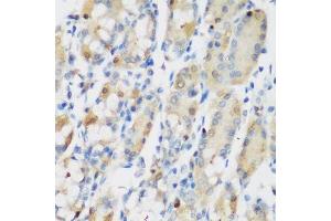 Immunohistochemistry (Paraffin-embedded Sections) (IHC (p)) image for anti-Ribonucleotide Reductase M1 (RRM1) (AA 593-792) antibody (ABIN3021563)