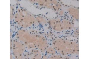 IHC-P analysis of Kidney tissue, with DAB staining. (JMJD6 Antikörper  (AA 1-334))
