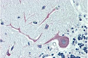 ABIN185115 (5µg/ml) staining of paraffin embedded Human Cerebellum. (OSBPL1A Antikörper  (C-Term))