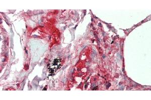 Immunohistochemistry of paraffin-embedded Lung tissue using IL19 Polyclonal Antibody at dilution of 1:90 . (IL-19 Antikörper)