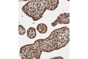 Immunohistochemical analysis of A on paraffin-embedded Human placenta tissue.