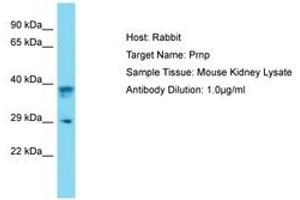Image no. 1 for anti-Prion Protein (PRNP) (AA 91-140) antibody (ABIN6750495) (PRNP Antikörper  (AA 91-140))