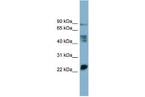 WB Suggested Anti-MPZL1  Antibody Titration: 0. (MPZL1 Antikörper  (Middle Region))