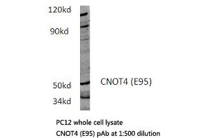 Western blot (WB) analysis of CNOT4 antibody in extracts from PC12 cells. (CNOT4 Antikörper)