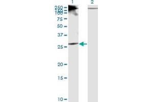 Western Blot analysis of RICTOR expression in transfected 293T cell line by RICTOR monoclonal antibody (M01), clone 1F3. (RICTOR Antikörper  (AA 1-98))