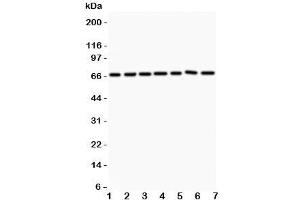 Western blot testing of ANG1 antibody and Lane 1:  HeLa;  2: MCF-7;  3: COLO320;  4: A549;  5: HEPG2;  6: 293T;  7: SW620.