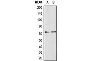 Western blot analysis of Glucagon Receptor expression in PC12 (A), Jurkat (B) whole cell lysates.