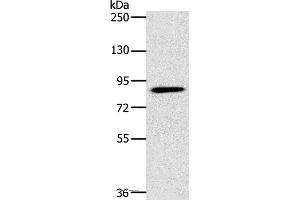 Western blot analysis of 293T cell, using PLEKHG6 Polyclonal Antibody at dilution of 1:400 (PLEKHG6 Antikörper)