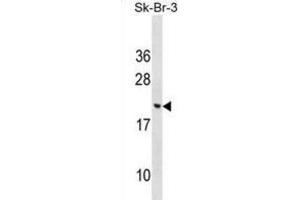 Western Blotting (WB) image for anti-Cornichon Homolog 3 (CNIH3) antibody (ABIN2999518) (CNIH3 Antikörper)