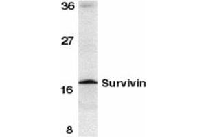 Image no. 1 for anti-Baculoviral IAP Repeat-Containing 5 (BIRC5) (C-Term) antibody (ABIN204355) (Survivin Antikörper  (C-Term))