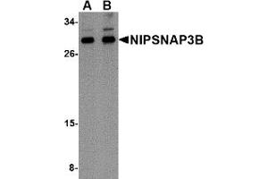 Western Blotting (WB) image for anti-Nipsnap Homolog 3B (NIPSNAP3B) (Middle Region) antibody (ABIN1031018) (NIPSNAP3B Antikörper  (Middle Region))