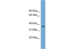 Human U937; WB Suggested Anti-NUBP1 Antibody Titration: 0. (NUBP1 Antikörper  (N-Term))
