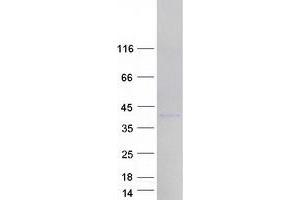 HNRNPA1L2 Protein (Transcript Variant 1) (Myc-DYKDDDDK Tag)