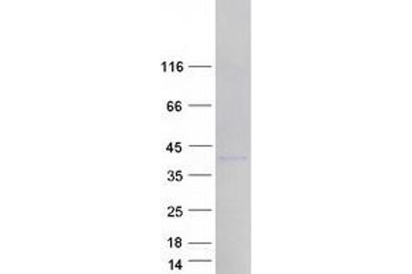 HNRNPA1L2 Protein (Transcript Variant 1) (Myc-DYKDDDDK Tag)