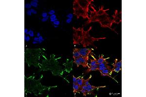 Immunocytochemistry/Immunofluorescence analysis using Mouse Anti-Alpha B Crystallin Monoclonal Antibody, Clone 1A7.