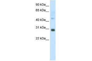 WB Suggested Anti-DLX5 Antibody Titration:  1. (DLX5 Antikörper  (C-Term))