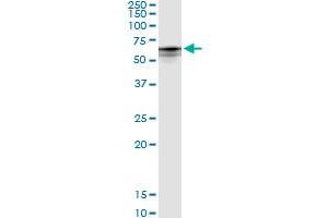 Immunoprecipitation of CYP4B1 transfected lysate using rabbit polyclonal anti-CYP4B1 and Protein A Magnetic Bead