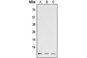 Western blot analysis of CCL26 expression in HEK293T (A), Raw264. (CCL26 Antikörper  (Center))