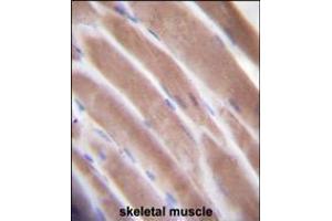 VEGF3 Antibody immunohistochemistry analysis in formalin fixed and paraffin embedded human skeletal muscle followed by peroxidase conjugation of the secondary antibody and DAB staining. (VEGFC Antikörper  (N-Term))