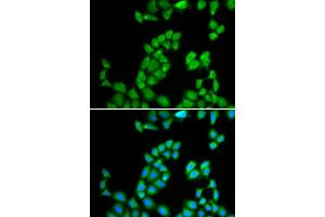 Immunofluorescence analysis of MCF-7 cell using RNASE13 antibody. (RNASE13 Antikörper)