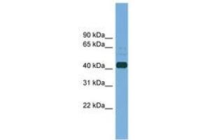 Image no. 1 for anti-Plasminogen Activator, Tissue (PLAT) (AA 323-372) antibody (ABIN6745203) (PLAT Antikörper  (AA 323-372))