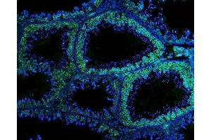 IF analysis of DDX4 using anti-DDX4 antibody (ABIN7601203).