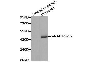Western blot analysis of extracts from mouse brain tissue using Phospho-MAPT-S262 antibody (ABIN2988151). (MAPT Antikörper  (pSer262))