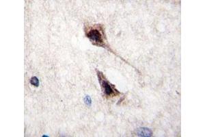 IHC analysis of FFPE human brain tissue stained with MEF2C antibody (MEF2C Antikörper  (AA 365-394))