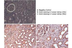 Immunohistochemistry with anti-Glut2 antibody showing Glut2 staining in nucleus and cytoplasm of ductal epithelium and of renal glomeruli in human kidney at 20x and 40x (B & C). (SLC2A2 Antikörper  (C-Term))