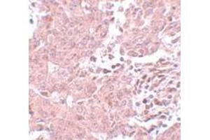 Immunohistochemistry (IHC) image for anti-Breast Carcinoma Amplified Sequence 3 (BCAS3) (N-Term) antibody (ABIN1031263) (BCAS3 Antikörper  (N-Term))