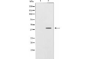 Western blot analysis on SK-OV3 cell lysate using NRG1 isoform-10 Antibody,The lane on the left is treated with the antigen-specific peptide. (Neuregulin 1 Antikörper  (N-Term))