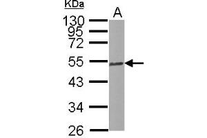 TUBB2C Antikörper  (Internal Region)