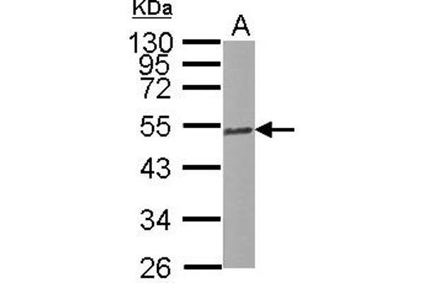 TUBB2C Antikörper  (Internal Region)