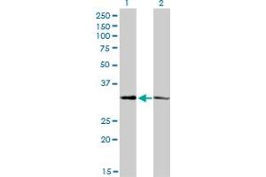 Western Blot analysis of CRSP8 expression in transfected 293T cell line by CRSP8 monoclonal antibody (M01), clone 8B8.
