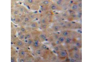Used in DAB staining on fromalin fixed paraffin-embedded Liver tissue (IGFBP4 Antikörper  (AA 22-258))